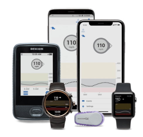 Dexcom user examples